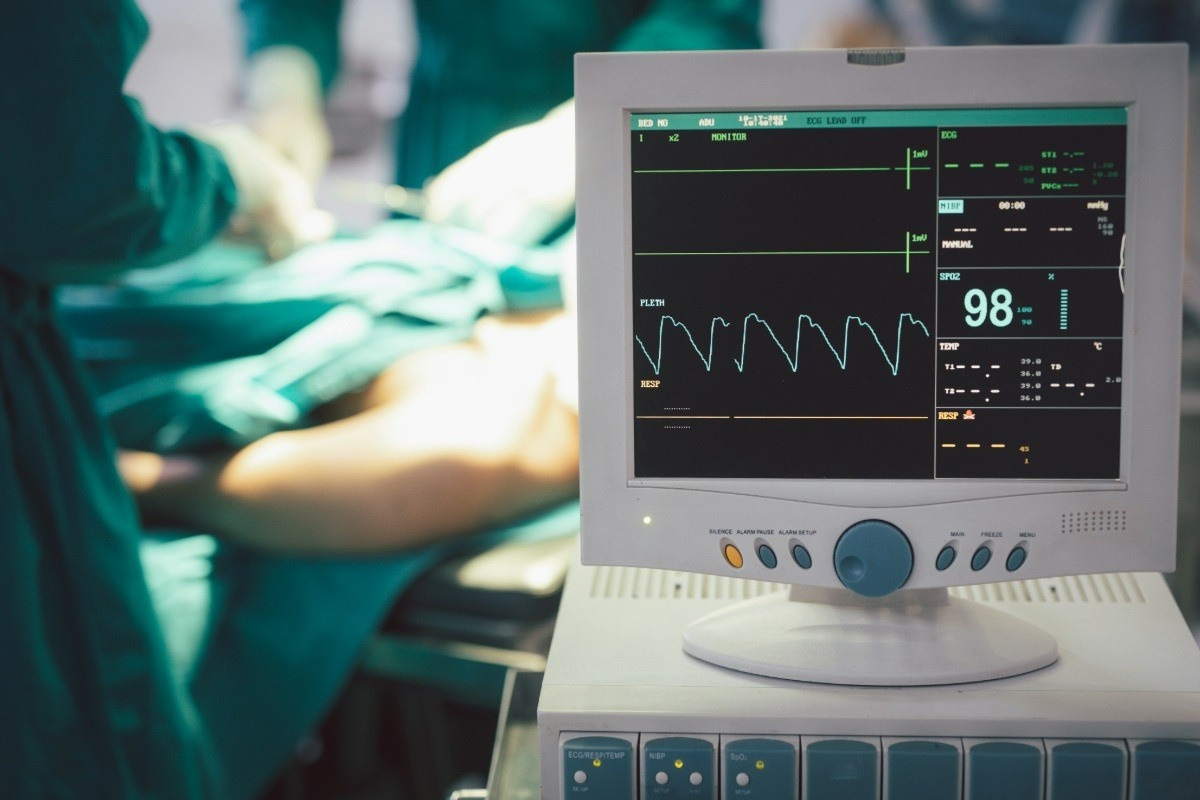 Measurement and management of adult blood pressure in the peri-operative period: updated guidelines from the Association of Anaesthetists and the British and Irish Hypertension Society.