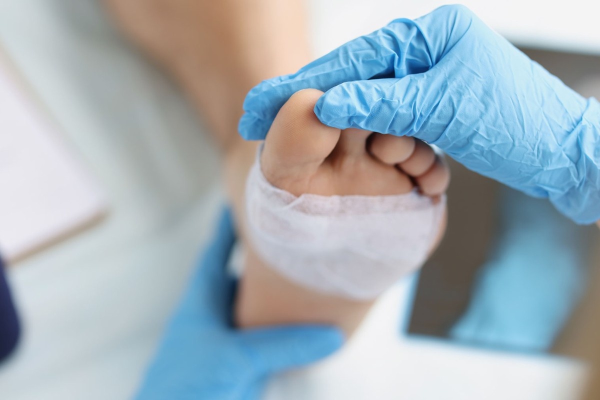 Close up of pair of blue gloved hands holding a foot with a bandage on it.