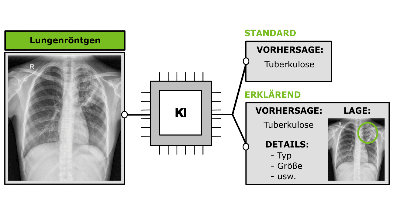 Bild: Visualisierung von XAI-Ablauf im biomedizinischen Bereich
